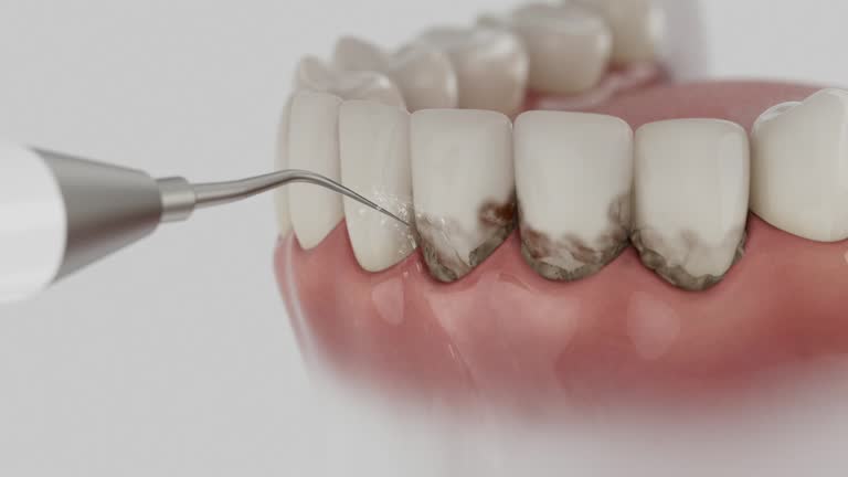 Reliable Wisdom Tooth Removal contractor in Richland County County, WI by Dentist Open Now